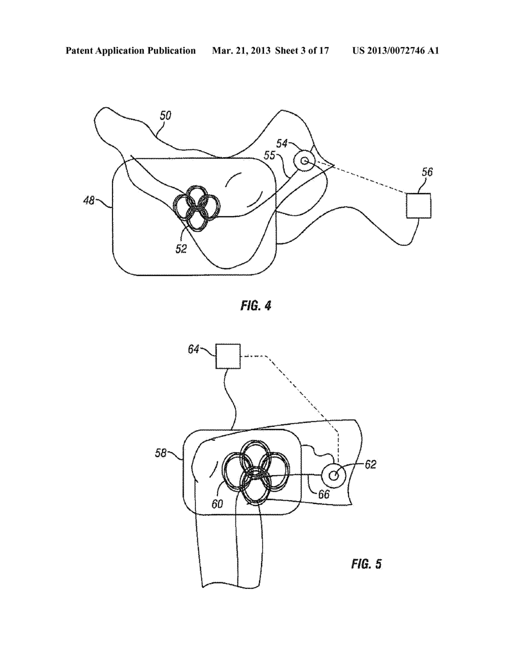 METHOD AND APPARATUS FOR MAGNETIC INDUCTION THERAPY - diagram, schematic, and image 04