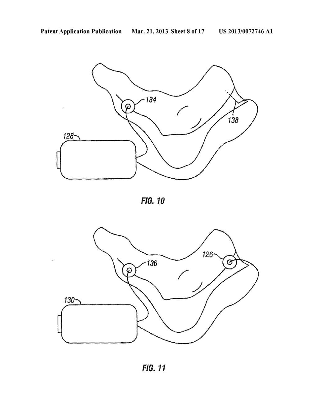 METHOD AND APPARATUS FOR MAGNETIC INDUCTION THERAPY - diagram, schematic, and image 09