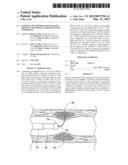 SYSTEMS AND METHODS FOR TREATING OBESITY AND OTHER GASTROINTESTINAL     CONDITIONS diagram and image