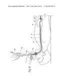 SYSTEMS AND METHODS FOR TREATING OBESITY AND OTHER GASTROINTESTINAL     CONDITIONS diagram and image