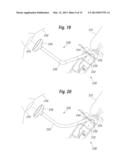 NASAL AEROSOL DELIVERY SYSTEM diagram and image