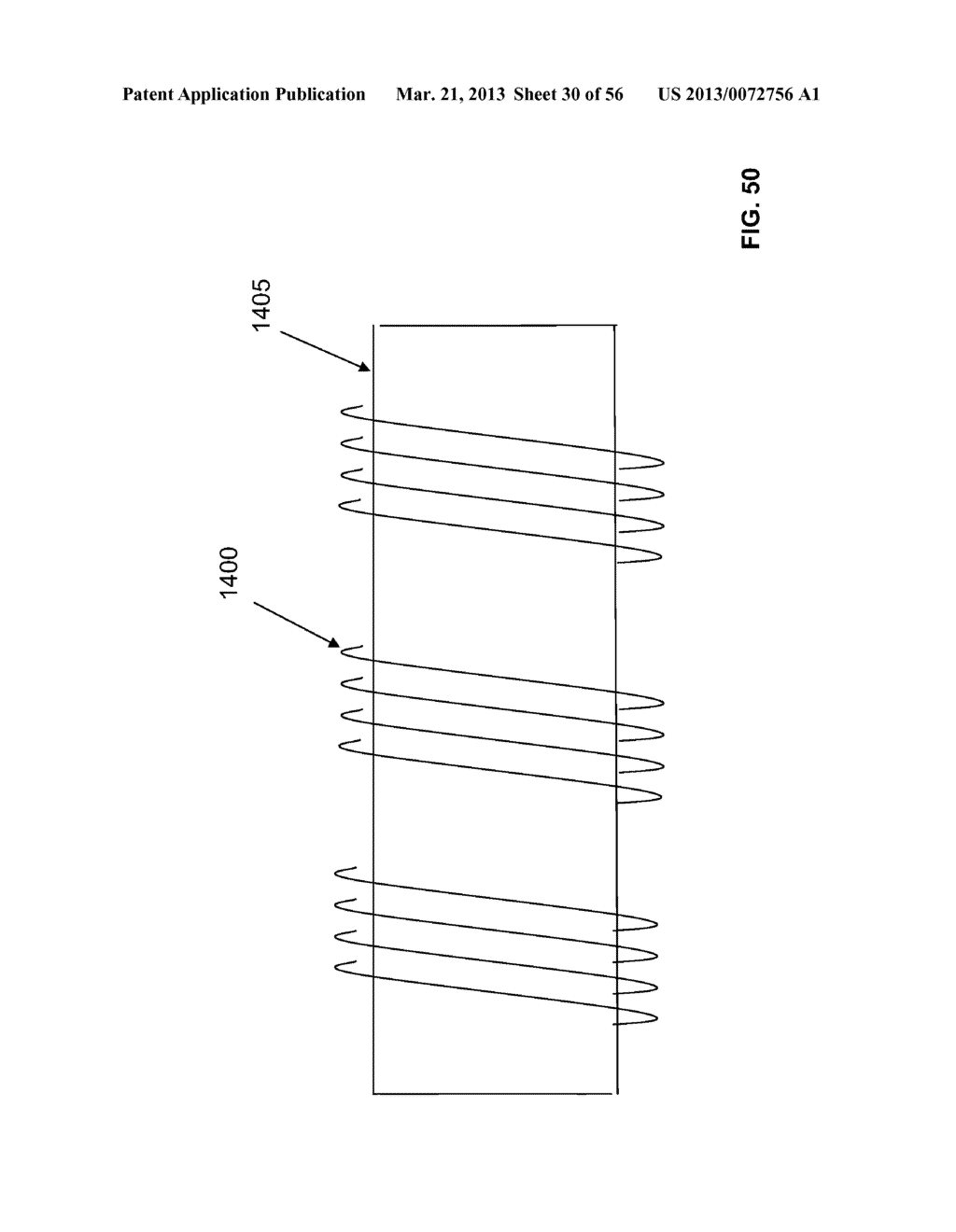 ROTATE-TO-ADVANCE CATHETERIZATION SYSTEM - diagram, schematic, and image 31