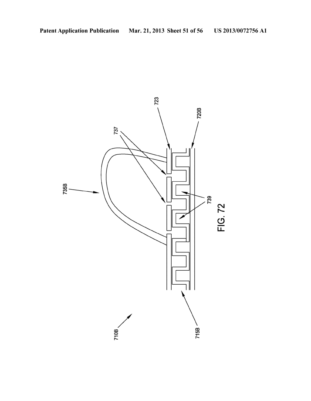 ROTATE-TO-ADVANCE CATHETERIZATION SYSTEM - diagram, schematic, and image 52