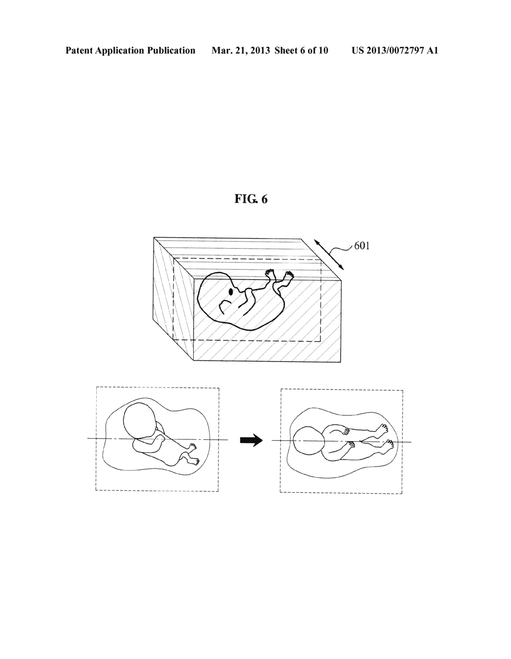 3D ULTRASOUND APPARATUS AND METHOD FOR OPERATING THE SAME - diagram, schematic, and image 07