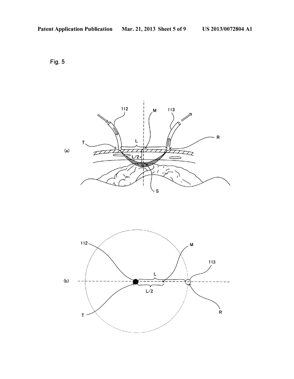 LIGHT TRANSMITTING PROBE, LIGHT RECEIVING PROBE, LIGHT TRANSMITTING AND     RECEIVING PROBE, AND LIGHT MEASUREMENT DEVICE USING SAME - diagram, schematic, and image 06