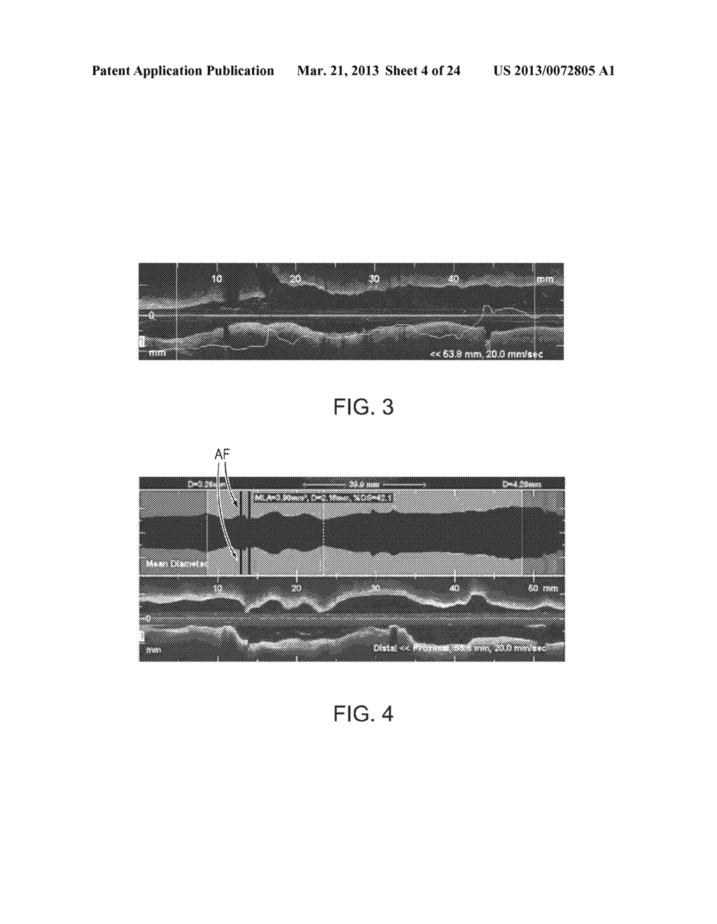 Lumen Morphology and Vascular Resistance Measurements Data Collection     Systems, Apparatus and Methods - diagram, schematic, and image 05