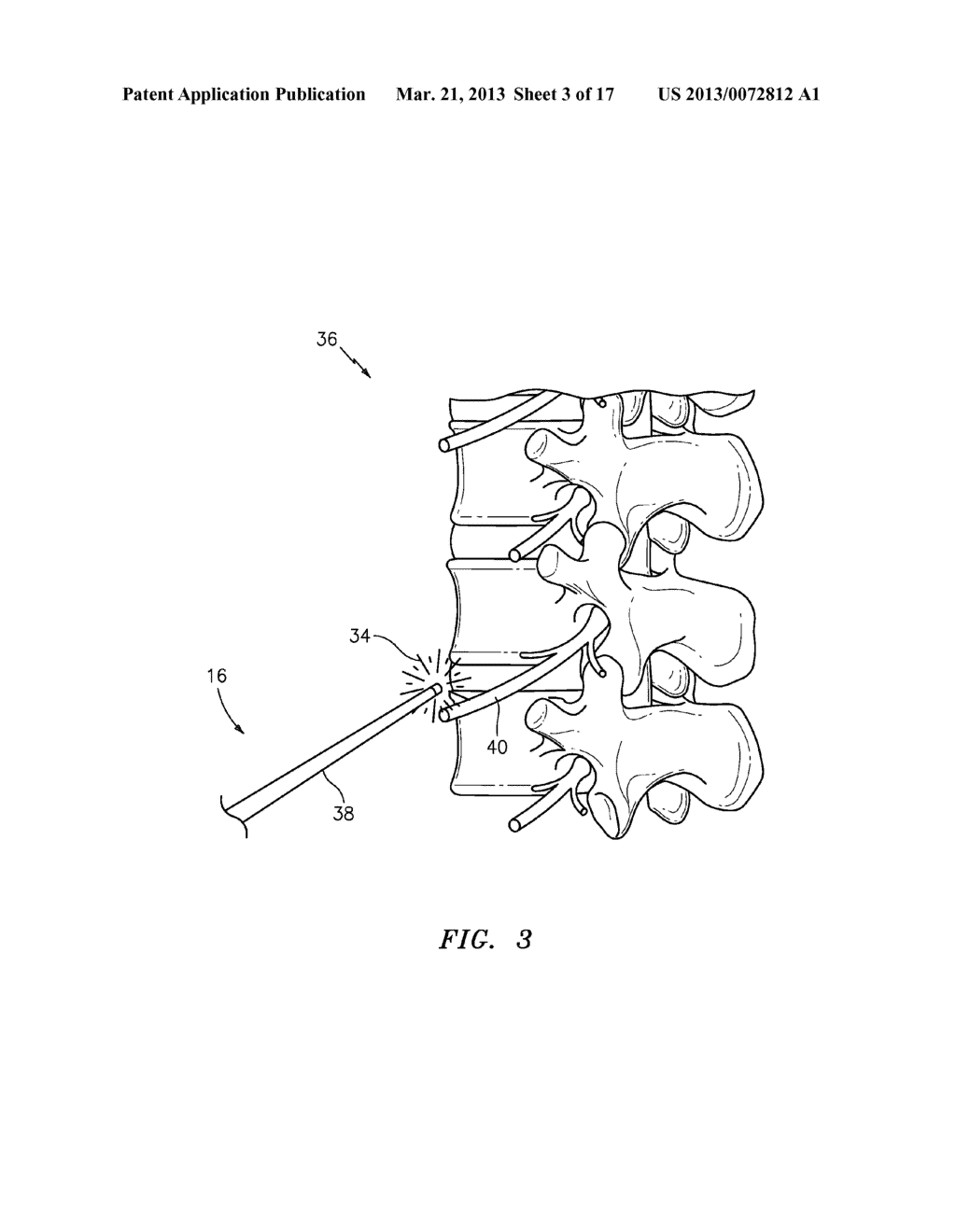 NEURAL MONITORING SYSTEM - diagram, schematic, and image 04