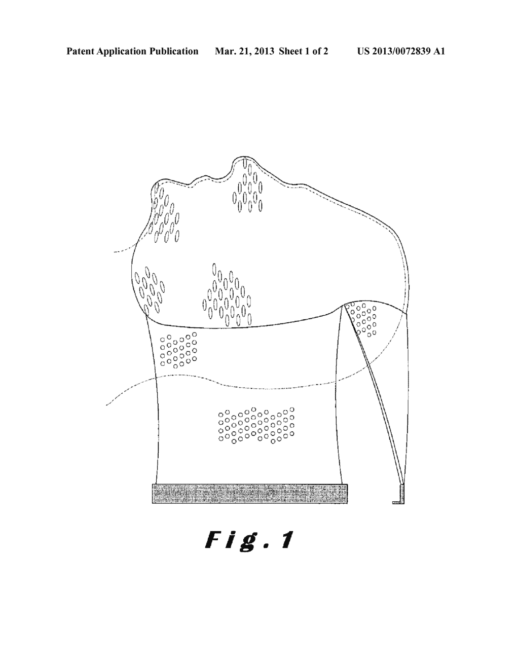 IMMOBILIZATION DEVICE - diagram, schematic, and image 02