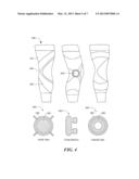 Knee Brace with Expandable Members and Method of Using the Same diagram and image