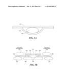 Knee Brace with Expandable Members and Method of Using the Same diagram and image