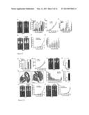 USE OF ENTRAINED NEUTROPHILS TO TREAT METASTATIC AND MICROMETASTATIC     DISEASE IN AT RISK PATIENTS diagram and image