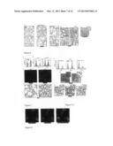 USE OF ENTRAINED NEUTROPHILS TO TREAT METASTATIC AND MICROMETASTATIC     DISEASE IN AT RISK PATIENTS diagram and image