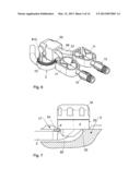 IMPLANTED ACCESS PORT diagram and image