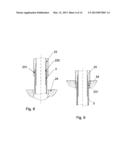 IMPLANTED ACCESS PORT diagram and image