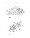 IMPLANTED ACCESS PORT diagram and image