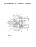 IMPLANTED ACCESS PORT diagram and image