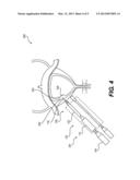 APPARATUS FOR TREATING AN ORGAN AND RELATED METHODS OF USE diagram and image