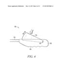 Articulating Handle for a Deflectable Catheter and Method Therefor diagram and image