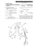 METHOD AND SYSTEM FOR SUSTAINED-RELEASE OF SCLEROSING AGENT diagram and image