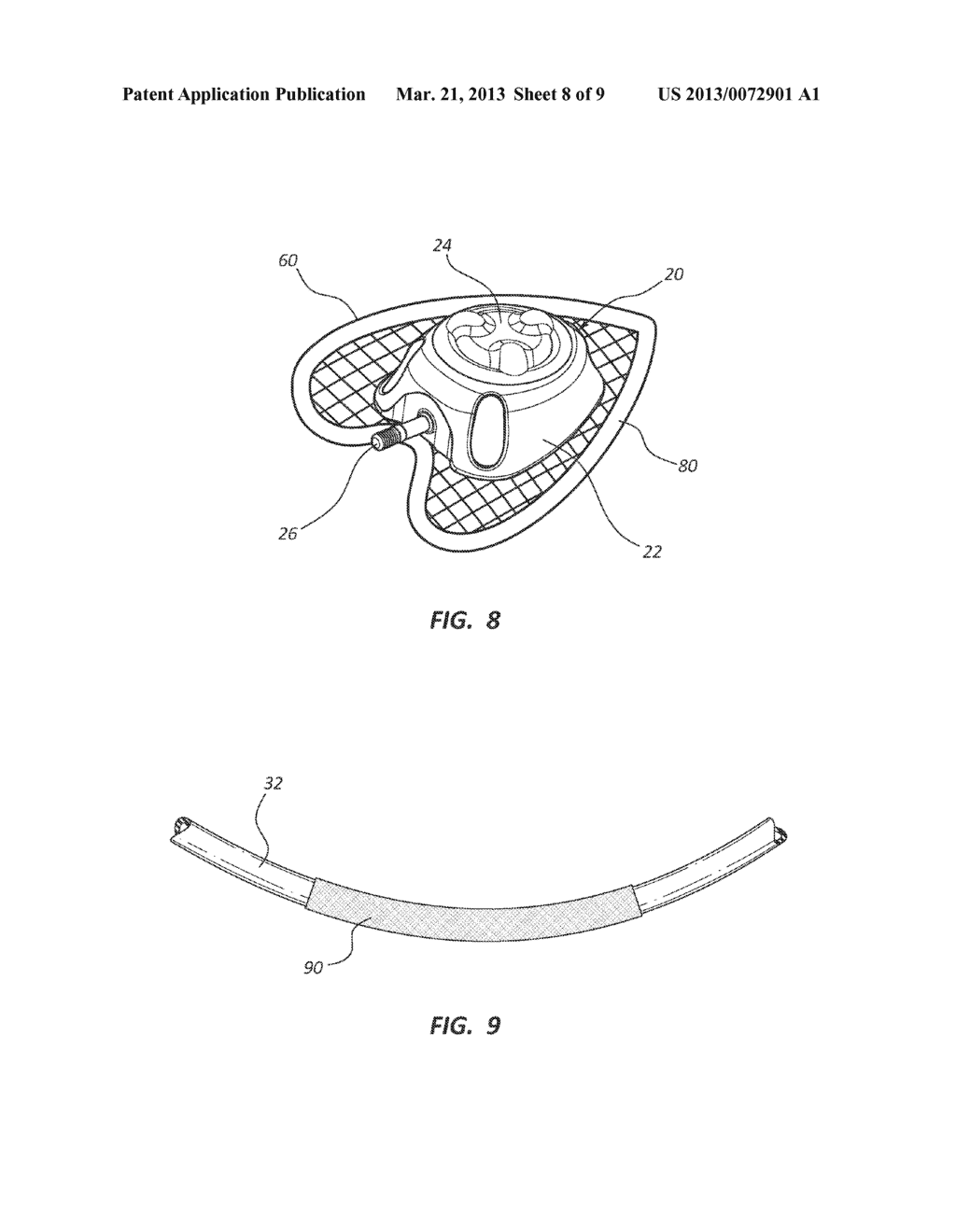 Fixation and Protection of an Implanted Medical Device - diagram, schematic, and image 09