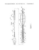 CATHETER HAVING IMPROVED BONDING REGION diagram and image