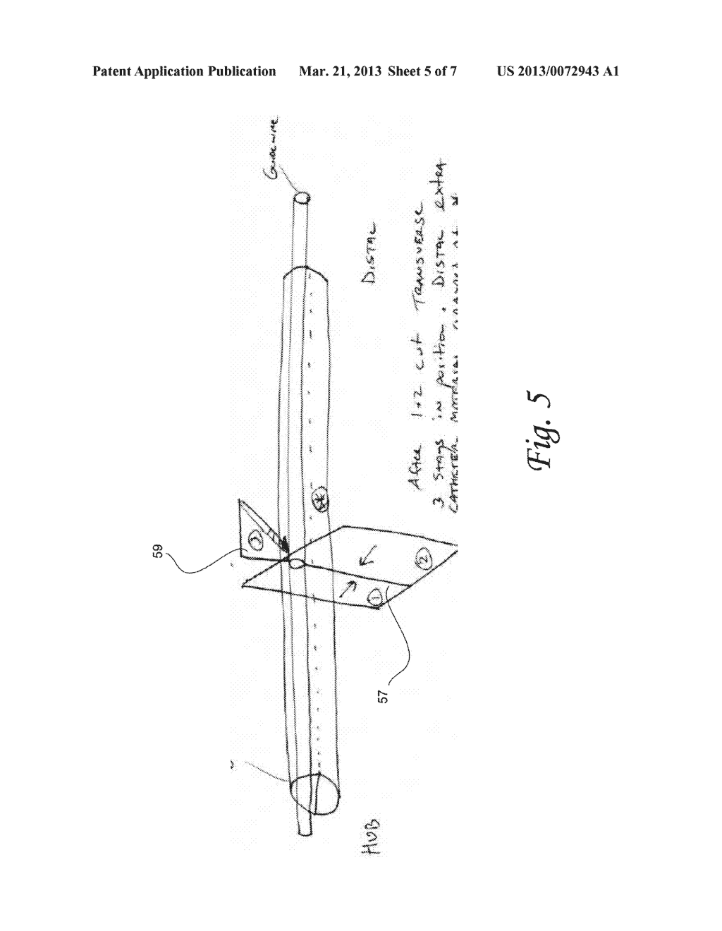 EM Guidance Device For A Device Enabled For Endovascular Navigation     Placement Including A Remote Operator Capability And EM Endoluminal     Imaging Technique - diagram, schematic, and image 06