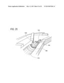 LIGATION DEVICE, CLIP UNIT, CLIP MANIPULATION DEVICE, AND ENDOSCOPE SYSTEM diagram and image