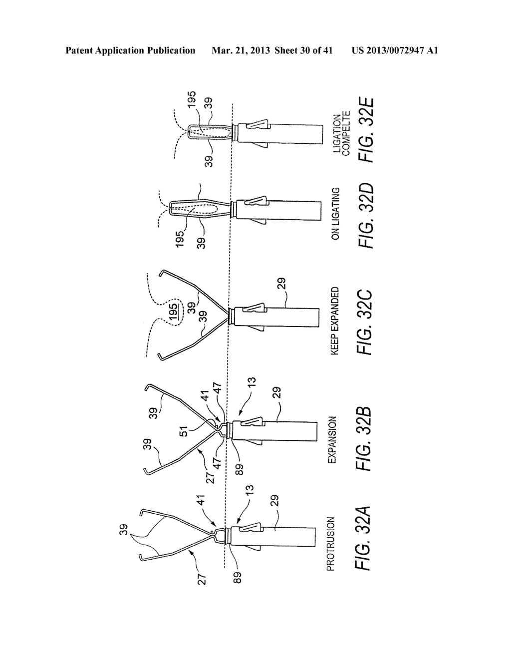 CLIP UNIT, LIGATION DEVICE USING THE SAME, AND METHOD FOR FABRICATING THE     CLIP UNIT - diagram, schematic, and image 31