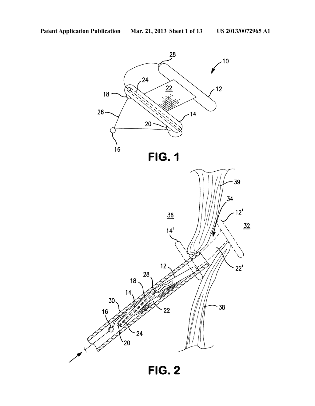 Delivery Systems and Methods for PFO Closure Device with Two Anchors - diagram, schematic, and image 02