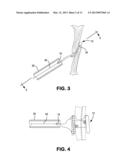 Delivery Systems and Methods for PFO Closure Device with Two Anchors diagram and image