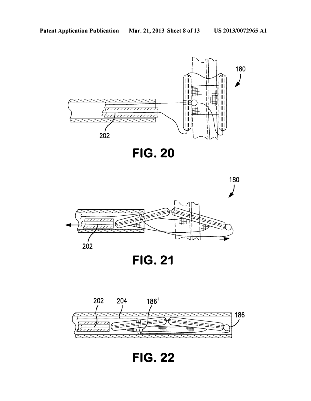 Delivery Systems and Methods for PFO Closure Device with Two Anchors - diagram, schematic, and image 09