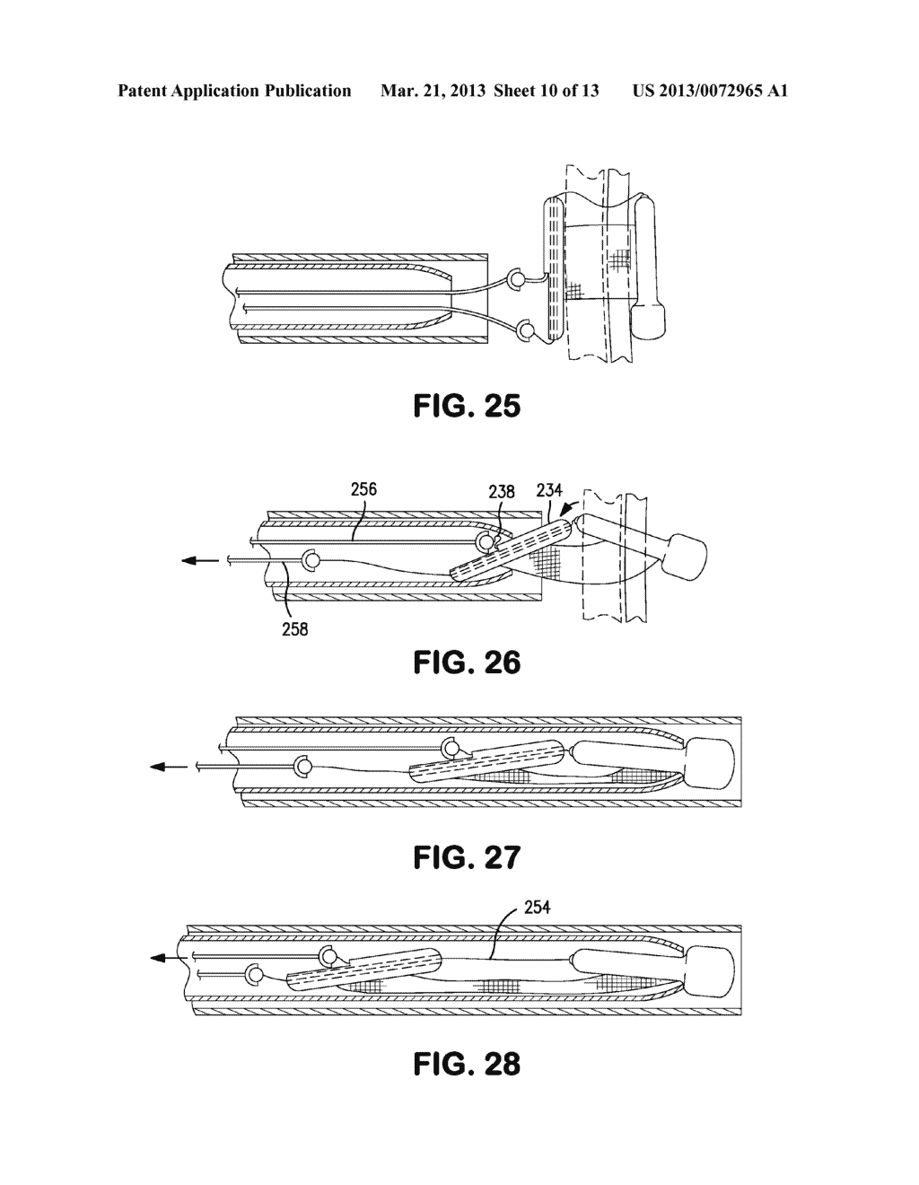 Delivery Systems and Methods for PFO Closure Device with Two Anchors - diagram, schematic, and image 11