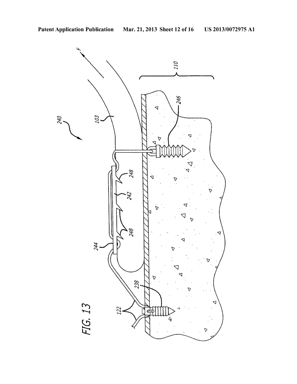 KNOTLESS SUTURE ANCHOR FOR SOFT TISSUE REPAIR AND METHOD OF USE - diagram, schematic, and image 13