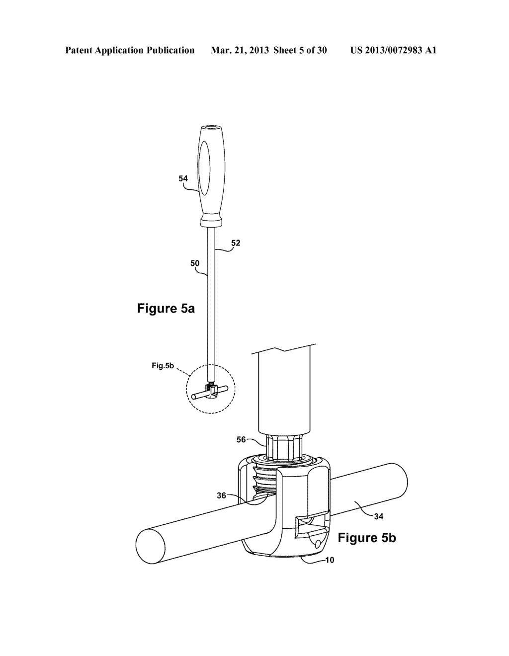 TETHER CLAMP AND IMPLANTATION SYSTEM - diagram, schematic, and image 06