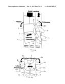 SYSTEMS AND METHODS FOR POSTERIOR DYNAMIC STABILIZATION OF THE SPINE diagram and image