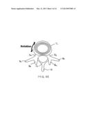 SYSTEMS AND METHODS FOR POSTERIOR DYNAMIC STABILIZATION OF THE SPINE diagram and image