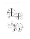 SYSTEMS AND METHODS FOR POSTERIOR DYNAMIC STABILIZATION OF THE SPINE diagram and image