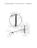 SYSTEMS AND METHODS FOR POSTERIOR DYNAMIC STABILIZATION OF THE SPINE diagram and image