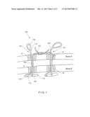 Strand for Minimally Invasive Removal of T-Anchor diagram and image