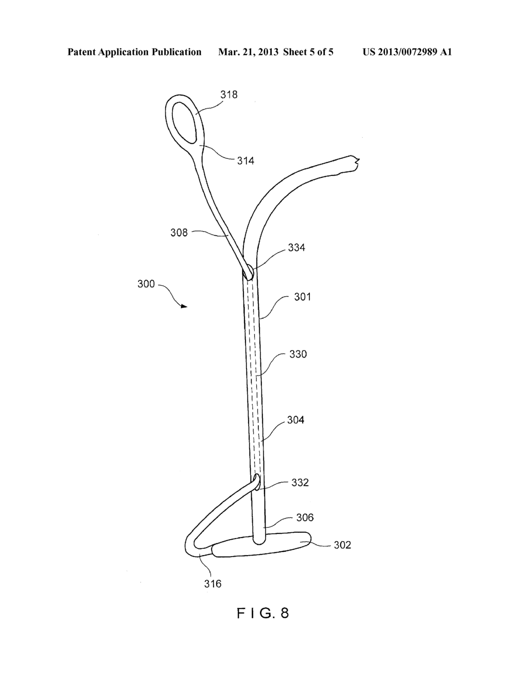 Strand for Minimally Invasive Removal of T-Anchor - diagram, schematic, and image 06