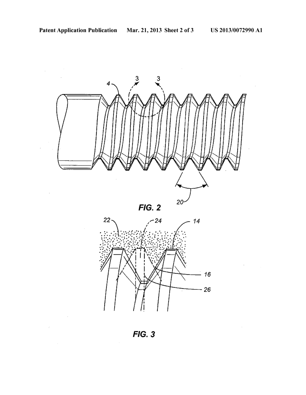 REVERSE THREAD BONE SCREW - diagram, schematic, and image 03