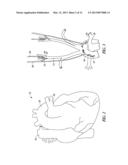 POWER SUPPLY MANAGEMENT FOR IMPLANTABLE NEUROSTIMULATION DEVICES diagram and image