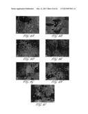 METHOD FOR TREATING A PATIENT HAVING A SPINAL CORD INJURY USING     PHOTOTHERAPY diagram and image