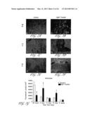 METHOD FOR TREATING A PATIENT HAVING A SPINAL CORD INJURY USING     PHOTOTHERAPY diagram and image