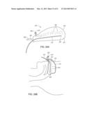 METHODS AND DEVICES FOR NON-INVASIVE CEREBRAL AND SYSTEMIC COOLING     ALTERNATING LIQUID MIST/GAS FOR INDUCTION AND GAS FOR MAINTENANCE diagram and image