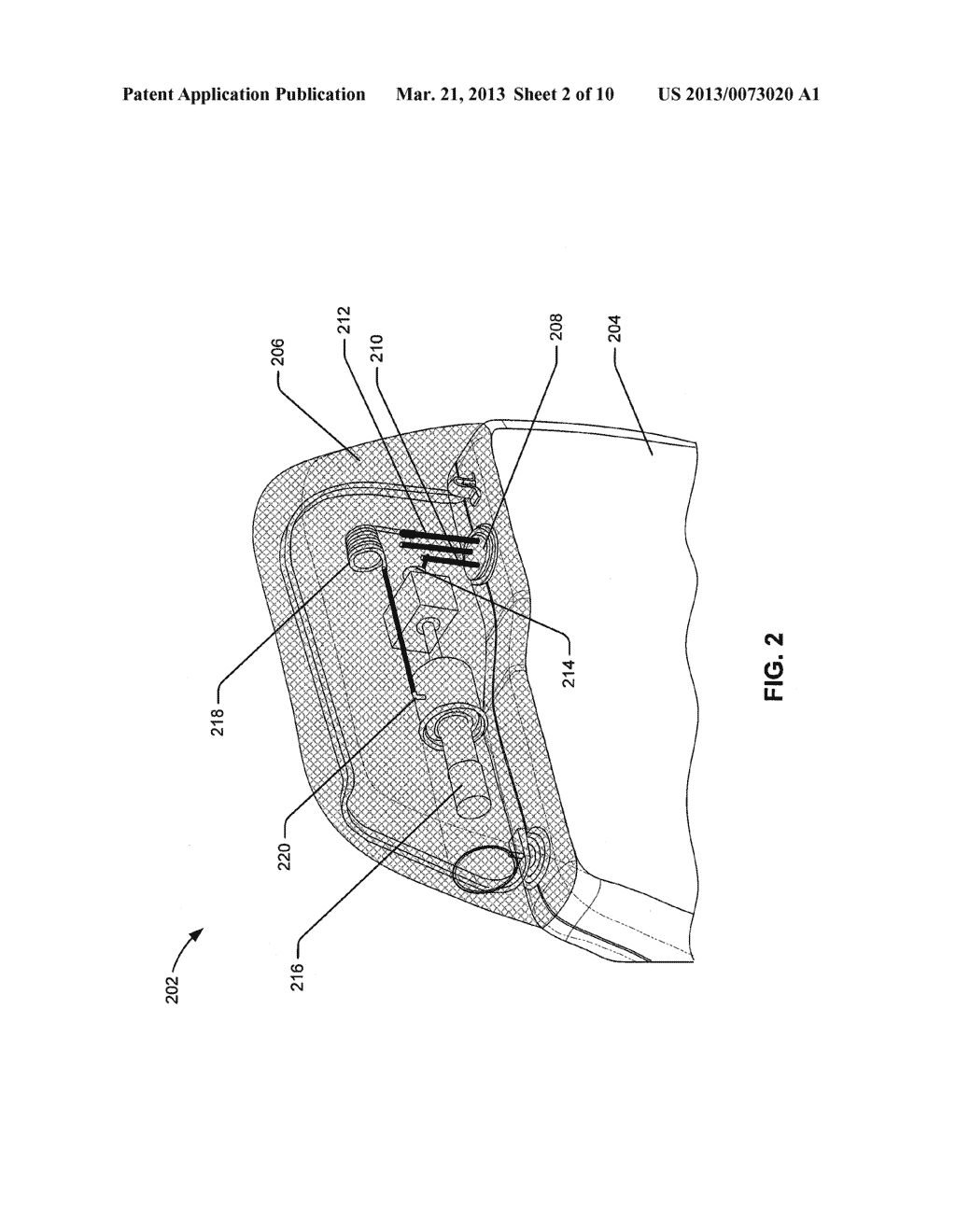 HEADER EMBEDDED FILTER FOR IMPLANTABLE MEDICAL DEVICE - diagram, schematic, and image 03