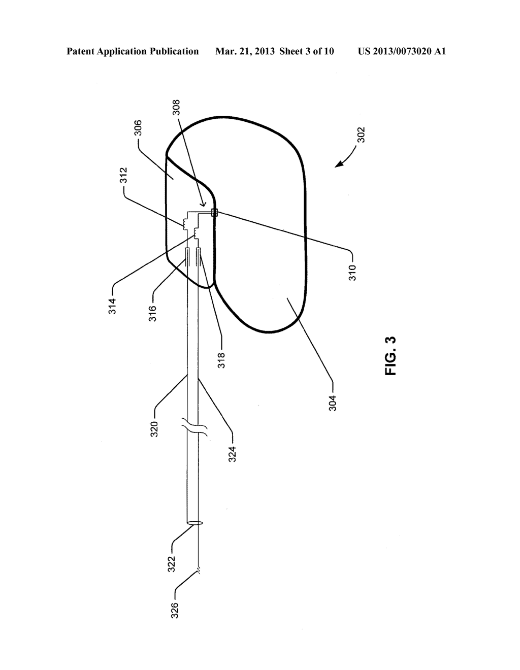 HEADER EMBEDDED FILTER FOR IMPLANTABLE MEDICAL DEVICE - diagram, schematic, and image 04