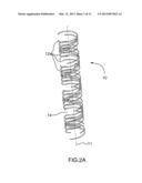 Stent diagram and image