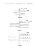 Stent diagram and image