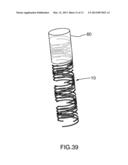 Stent diagram and image